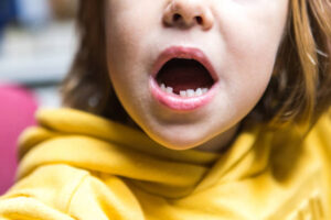 When Do Kids Start Losing Teeth